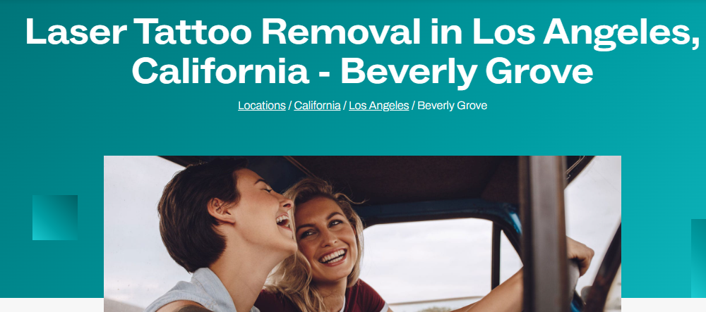 Best Tattoo Removal in Los Angeles